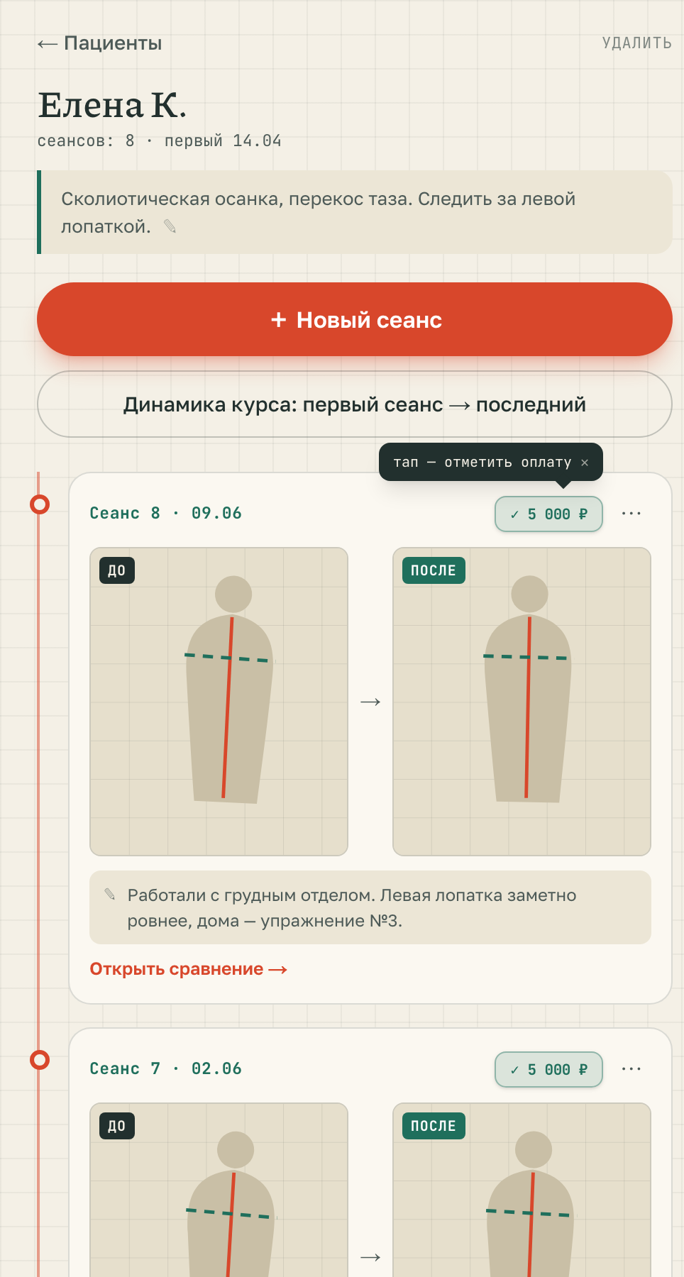 Карточка пациента: сеансы курса со снимками до и после